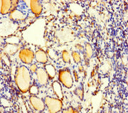 Immunohistochemistry of paraffin-embedded human thyroid tissue using CSB-PA004030LA01HU at dilution of 1:100