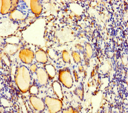 Immunohistochemistry of paraffin-embedded human thyroid tissue using CSB-PA004030LA01HU at dilution of 1:100