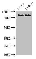 Western Blot Positive WB detected in: Rat liver tissue, Mouse kidney tissue All lanes: C6 antibody at 2.7ug/ml Secondary Goat polyclonal to rabbit IgG at 1/50000 dilution Predicted band size: 105 kDa Observed band size: 105 kDa