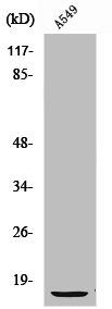 Western Blot analysis of A549 cells using S-100 α Polyclonal Antibody