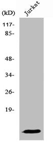 Western Blot analysis of Jurkat cells using S-100A10 Polyclonal Antibody