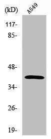 Western Blot analysis of A549 cells using Sarcoglycan-β Polyclonal Antibody
