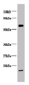Western blot All lanes: COX5B antibody at 2µg/ml + EC109 whole cell lysate Secondary Goat polyclonal to rabbit IgG at 1/15000 dilution Predicted band size: 14 kDa Observed band size: 14, 65 kDa