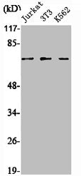 Western Blot analysis of Jurkat NIH-3T3 K562 cells using SENP1 Polyclonal Antibody