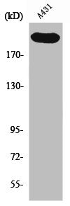 Western Blot analysis of A431 cells using Separase Polyclonal Antibody