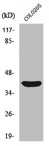 Western Blot analysis of COLO205 cells using Siah-2 Polyclonal Antibody