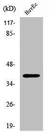 Western Blot analysis of HuvEc cells using Sideroflexin-4 Polyclonal Antibody