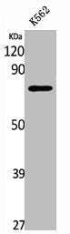 Western Blot analysis of K562 cells using SIRT1 Polyclonal Antibody