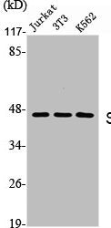 Western Blot analysis of Jurkat NIH-3T3 K562 cells using Skp2 p45 Polyclonal Antibody