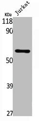 Western Blot analysis of Jurkat cells using Smad1 Polyclonal Antibody