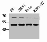 Western Blot analysis of 823 22RV1 HELA 293-UV cells using Smad2/3 Polyclonal Antibody
