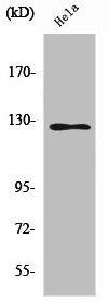 Western Blot analysis of HuvEc cells using SMG7 Polyclonal Antibody