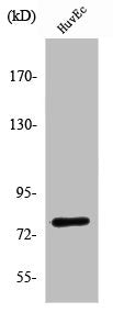 Western Blot analysis of Jurkat cells using SnoN Polyclonal Antibody