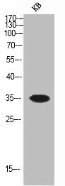 Western Blot analysis of KB cells using SOCS-1 Polyclonal Antibody