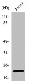 Western Blot analysis of Jurkat cells using SOCS-2 Polyclonal Antibody