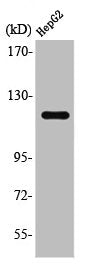 Western Blot analysis of Jurkat cells using SPT16 Polyclonal Antibody