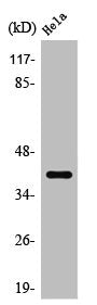 Western Blot analysis of HeLa cells using SR-1E Polyclonal Antibody