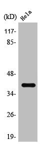 Western Blot analysis of HeLa cells using SR-5A Polyclonal Antibody