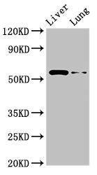 Western Blot Positive WB detected in: Rat liver tissue, Rat lung tissue All lanes: CCZ1 antibody at 2.5µg/ml Secondary Goat polyclonal to rabbit IgG at 1/50000 dilution Predicted band size: 56 kDa Observed band size: 56 kDa