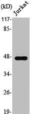 Western Blot analysis of Jurkat cells using SRF Polyclonal Antibody