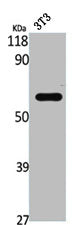 Western Blot analysis of NIH-3T3 cells using STAM2 Polyclonal Antibody