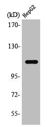 Western Blot analysis of HepG2 cells using Stat2 Polyclonal Antibody