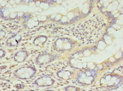Immunohistochemistry of paraffin-embedded human small intestine tissue using CSB-PA004182LA01HU at dilution of 1:100