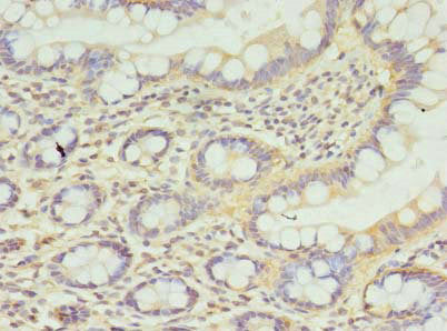 Immunohistochemistry of paraffin-embedded human small intestine tissue using CSB-PA004182LA01HU at dilution of 1:100