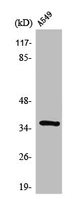 Western Blot analysis of A549 cells using STEAP1 Polyclonal Antibody