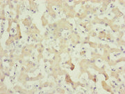 Immunohistochemistry of paraffin-embedded human liver tissue using CSB-PA004194ESR1HU at dilution of 1:100