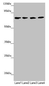 Western blot All lanes: C8B antibody at 1.28µg/ml Lane 1: Hela whole cell lysate Lane 2: Jurkat whole cell lysate Lane 3: Raji whole cell lysate Lane 4: Mouse liver tissue Secondary Goat polyclonal to rabbit IgG at 1/10000 dilution Predicted band...