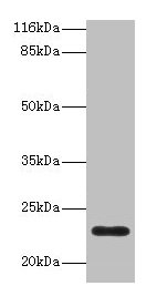 Western blot All lanes: C8G antibody at 2µg/ml + Human serum Secondary Goat polyclonal to rabbit IgG at 1/10000 dilution Predicted band size: 23 kDa Observed band size: 23 kDa