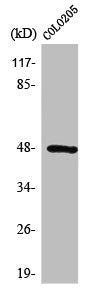 Western Blot analysis of CoLo205 cells using Synaptotagmin XI Polyclonal Antibody
