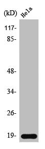 Western Blot analysis of HeLa cells using Synuclein-β Polyclonal Antibody