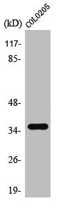 Western Blot analysis of COLO205 cells using T2R8 Polyclonal Antibody