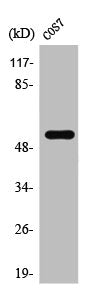 Western Blot analysis of COLO205 cells using TADA2L Polyclonal Antibody