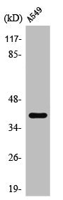Western Blot analysis of A549 cells using TASK-5 Polyclonal Antibody