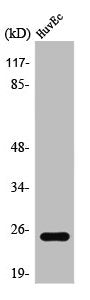 Western Blot analysis of Jurkat cells using TCEAL6 Polyclonal Antibody