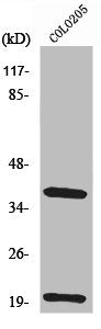 Western Blot analysis of COLO205 cells using TCR β Polyclonal Antibody