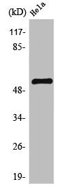 Western Blot analysis of Jurkat cells using TEL Polyclonal Antibody