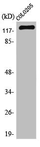 Western Blot analysis of COLO205 cells using TERT Polyclonal Antibody