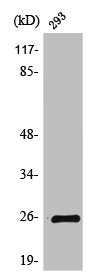 Western Blot analysis of COLO205 cells using Tetraspanin-8 Polyclonal Antibody