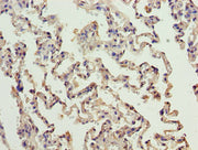 Immunohistochemistry of paraffin-embedded human lung tissue using CSB-PA004261LA01HU at dilution of 1:100