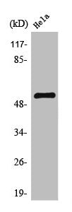 Western Blot analysis of HeLa cells using TFDP1 Polyclonal Antibody
