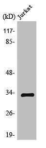Western Blot analysis of Jurkat cells using TFIIE-β Polyclonal Antibody