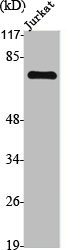 Western Blot analysis of Jurkat cells using TGFβ RII Polyclonal Antibody