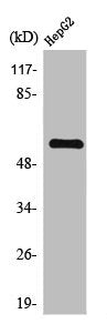 Western Blot analysis of HepG2 cells using TH Polyclonal Antibody