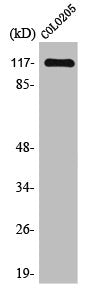 Western Blot analysis of COLO205 cells using TIF1α Polyclonal Antibody