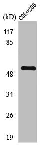 Western Blot analysis of COLO205 cells using TIGD3 Polyclonal Antibody