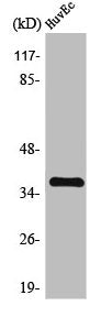 Western Blot analysis of MCF7 cells using TIS11B Polyclonal Antibody